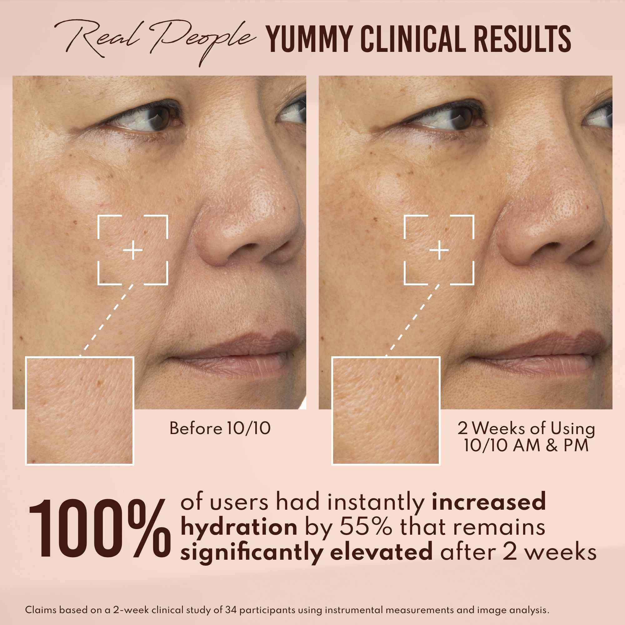 Yummy Skin 10/10 Barrier Boost Hyaluronic Acid + Ectoin Plumping Serum